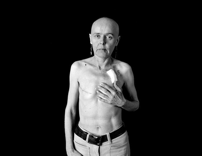 Pirjo Lahti-Brummund with breast cancer